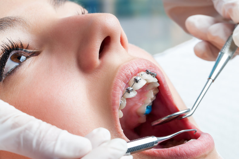 Dental Treatments 