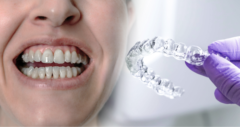 Invisalign London