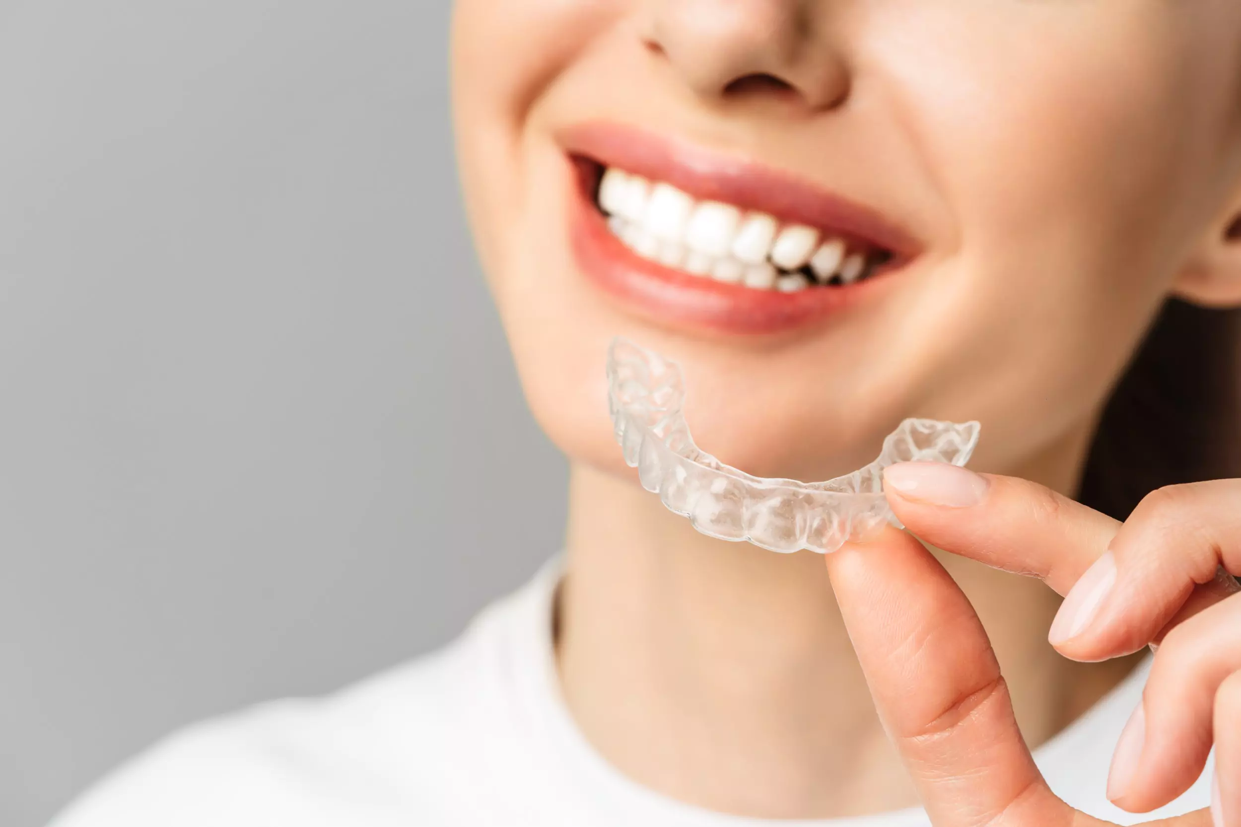 Invisalign: A Journey to Personalised Dental Precision